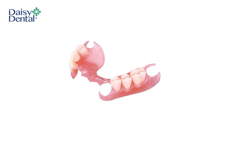 Răng giá tháo lắp bán phần nhựa dẻo có thể bị giãn sau một thời gian dùng