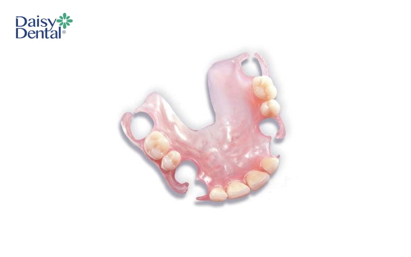 Chi phí sẽ là ưu điểm lớn nhất của răng giả tháo lắp bán phần