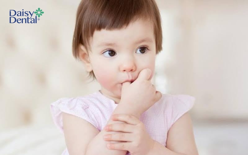 Mút tay là một trong những thói quen xấu dẫn đến tình trạng răng móm