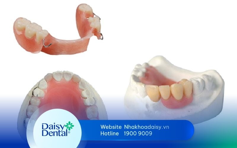 Răng giả tháo lắp bán phần
