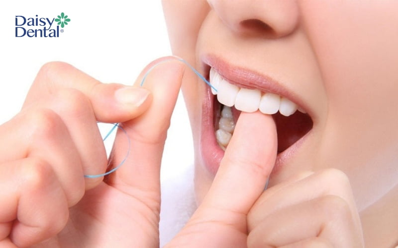 Sau khi trám răng mẻ, bạn cần chăm sóc đúng cách và khoa học để duy trì tuổi thọ miếng trám