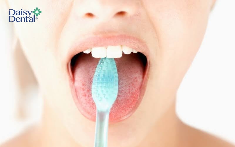 Bạn cũng có thể làm sạch lưỡi bằng bàn chải lông mềm