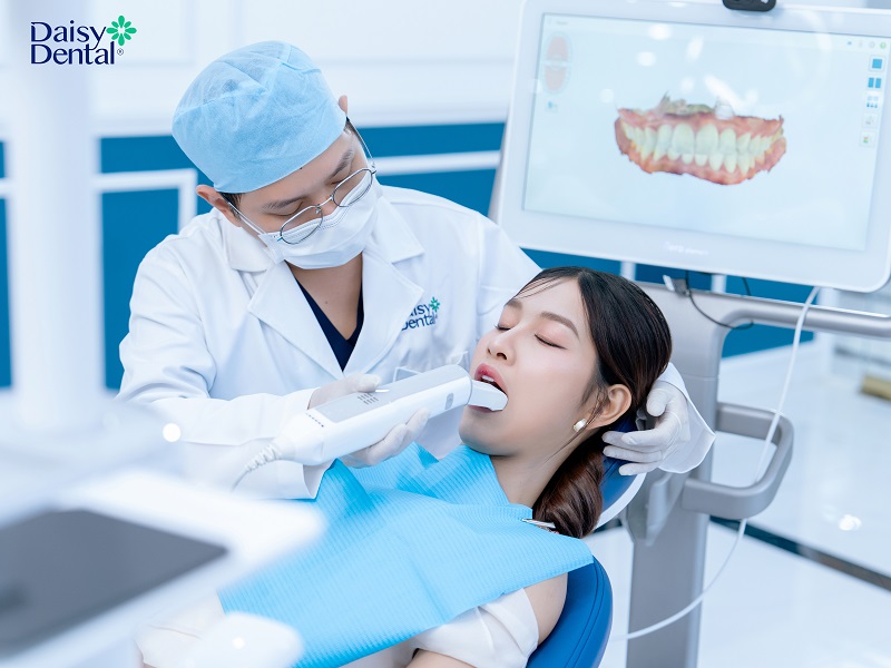 Công nghệ quét dấu răng iTero Element 5D Plus.