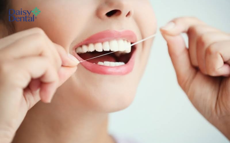 Bạn nên sử dụng chỉ nha khoa để loại bỏ sạch thức ăn ở kẽ răng