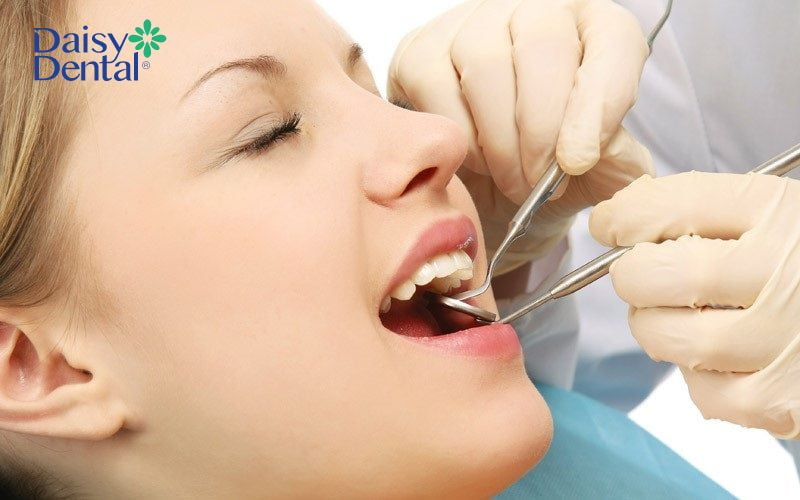 Lấy cao răng tại nha khoa đảm bảo an toàn, hiệu quả ngăn chặn các bệnh lý răng miệng
