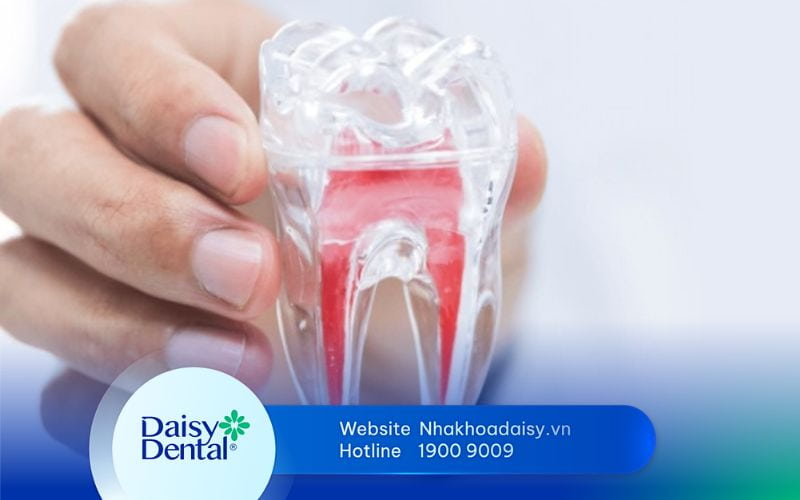 răng lấy tủy bị lung lay