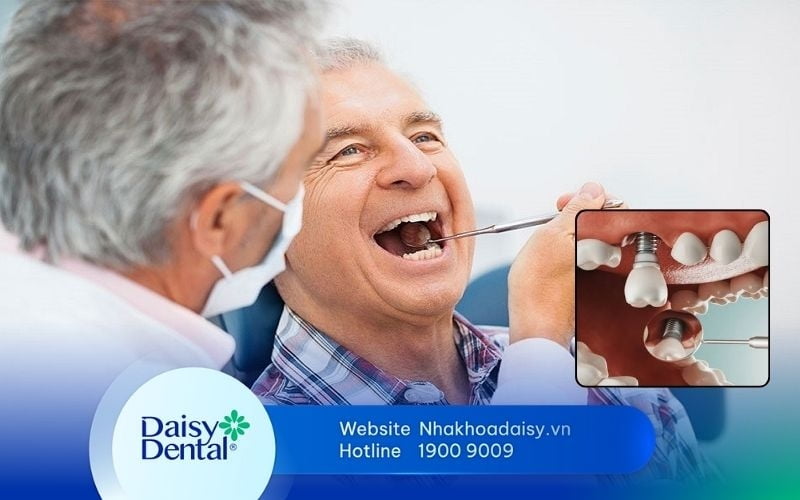 trồng răng Implant cho người già