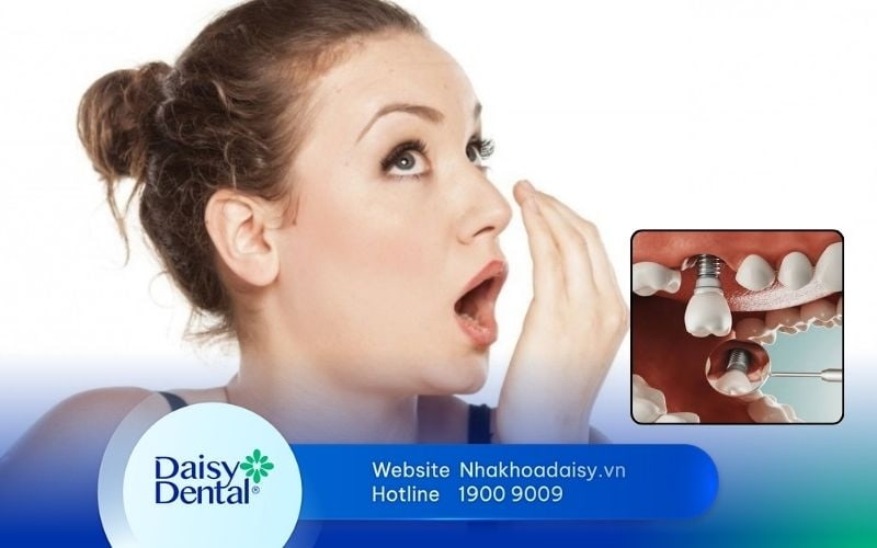 Trồng răng Implant có bị hôi miệng không