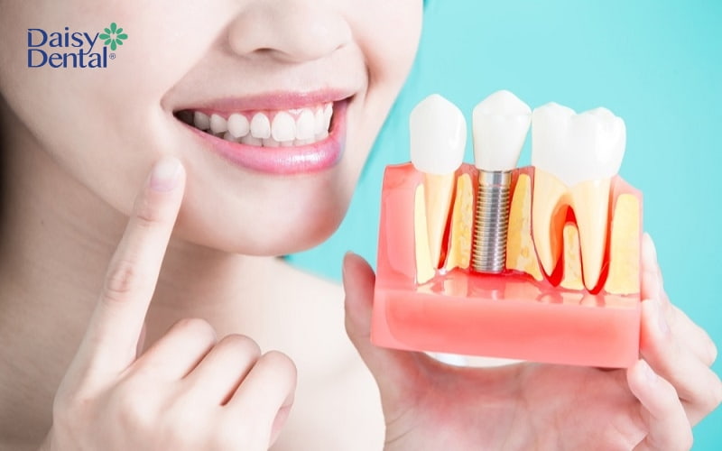 Trồng răng Implant không phải là nguyên nhân dẫn đến tình trạng hôi miệng