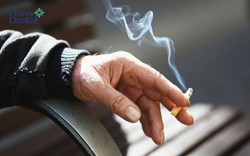 Hút thuốc lá tiềm ẩn nhiều nguy cơ gây hại cho sức khỏe răng miệng của người cấy ghép Implant
