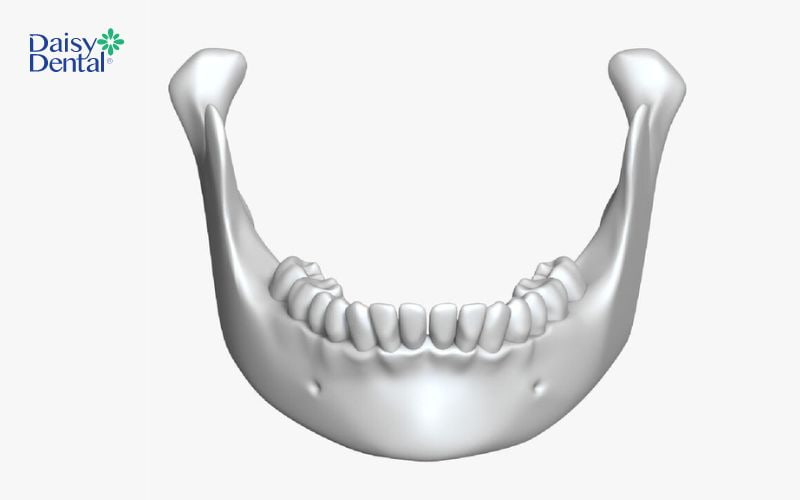Xương hàm không đủ kích thước sẽ khiến việc cấy ghép Implant thất bại