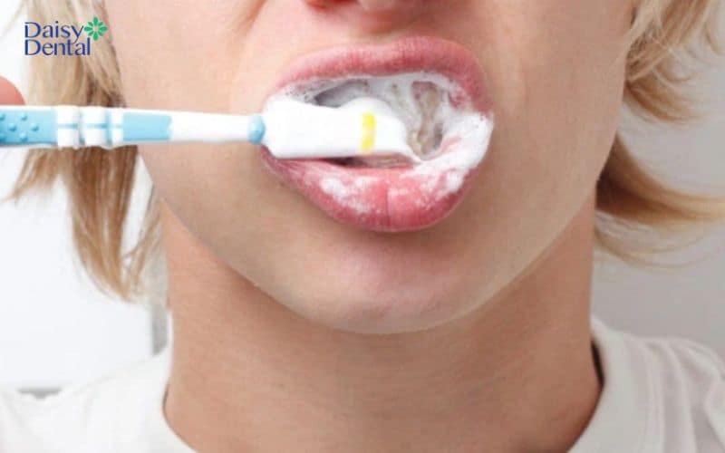 Vệ sinh răng không đúng cách sẽ làm tụt lợi hàm dưới
