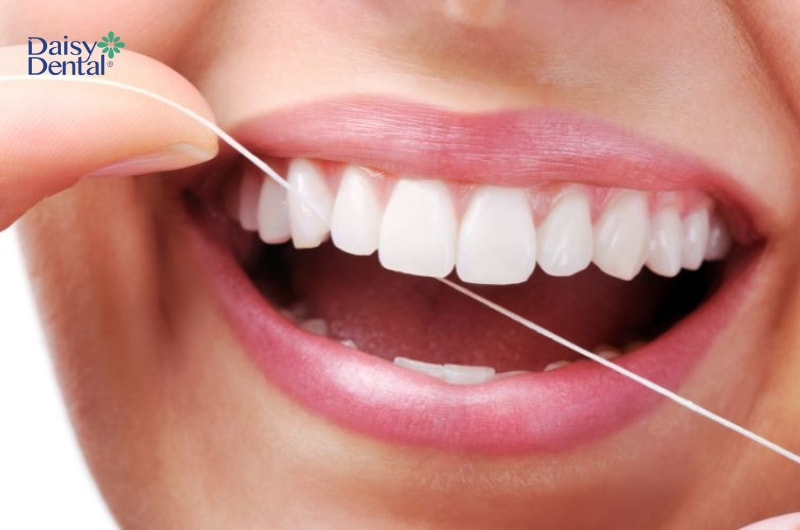 Tụt lợi răng lung lay