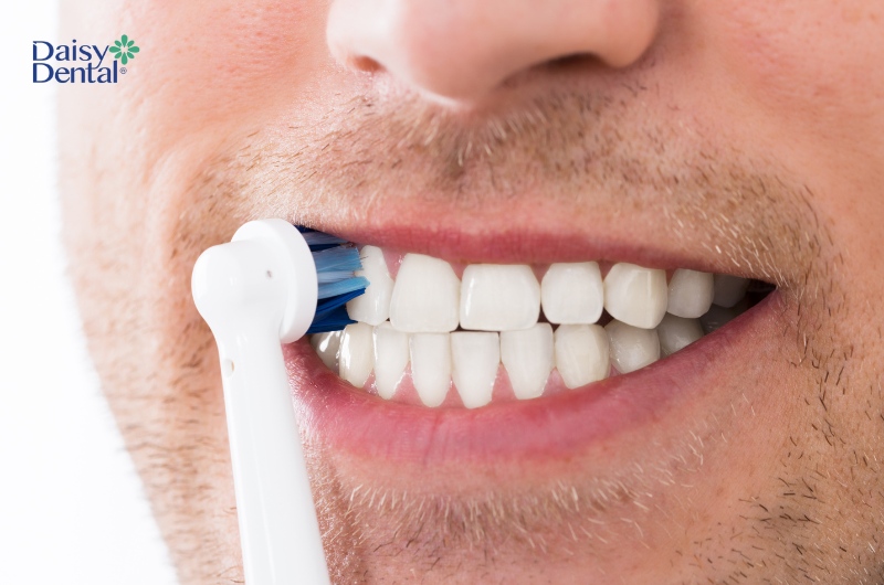 Bàn chải lông mềm sẽ giúp làm sạch kẽ răng, viền nướu hiệu quả mà không gây hại đến nướu răng