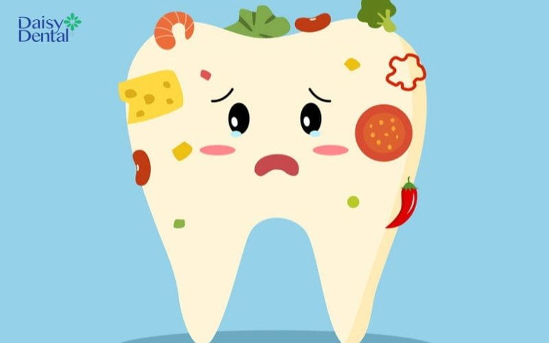 Vi khuẩn là nguyên nhân khá phổ biến gây nên tình trạng hôi miệng ở trẻ