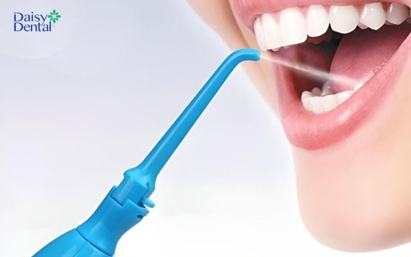 Sử dụng kết hợp máy tăm nước để vệ sinh răng sau khi điều trị tủy