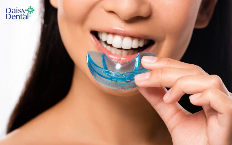 Sử dụng các dụng cụ bảo vệ hàm