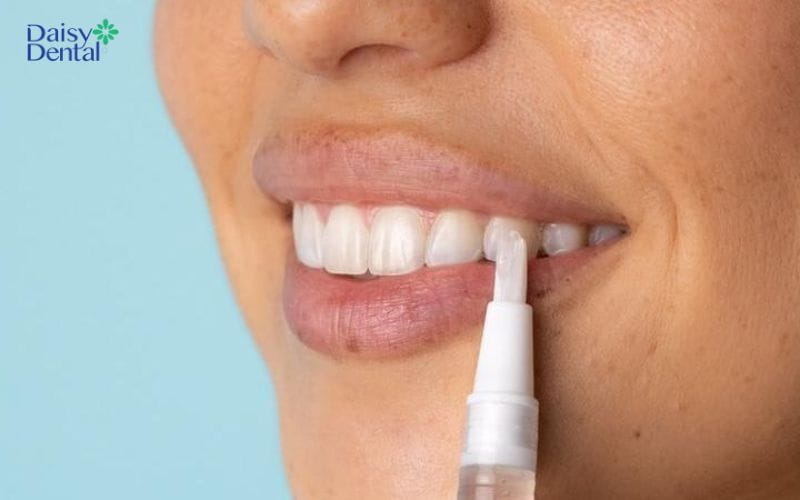 Thoa gel lên răng với lượng vừa đủ