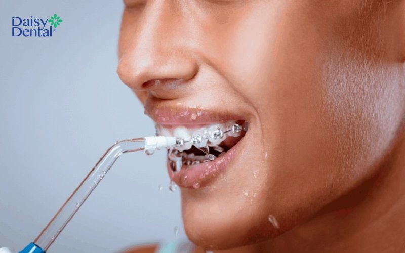 Máy có nhiều chế độ tùy chỉnh cho từng tình trạng răng miệng