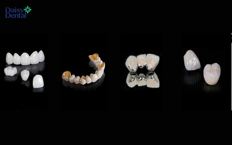 Chọn mão sứ chất lượng cao để làm thân răng giả
