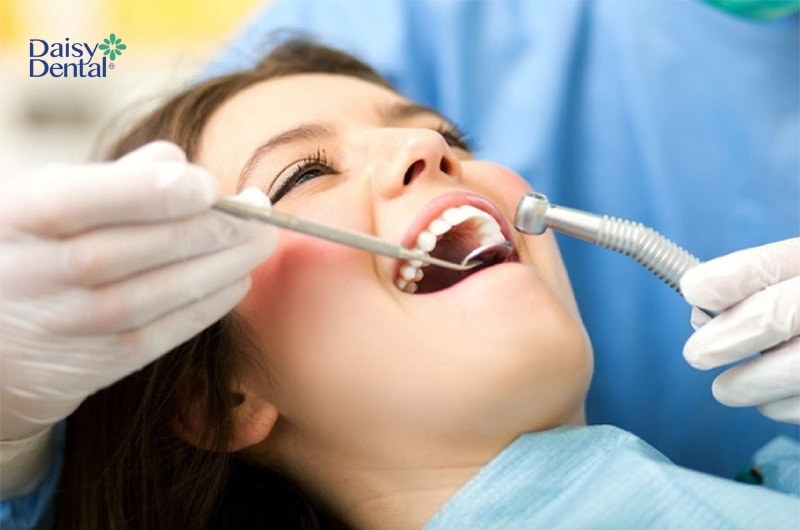 Bạn nên đến nha khoa để thực hiện cạo vôi răng chuyên nghiệp hơn