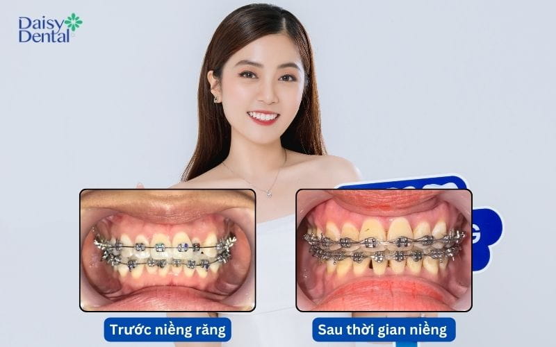 Khách hàng Thu Thủy rạng rỡ với nụ cười mới