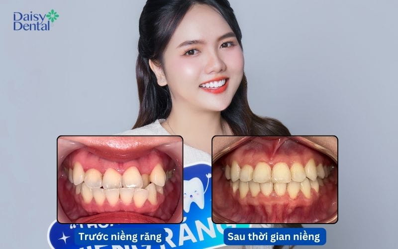 Khách hàng Ngọc Yên có nụ cười đều đẹp
