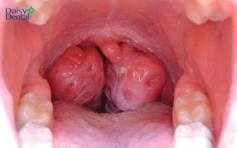 Đây là dấu hiệu cho thấy bạn cần đến bệnh viện ngay để tránh nguy hiểm đến tính mạng