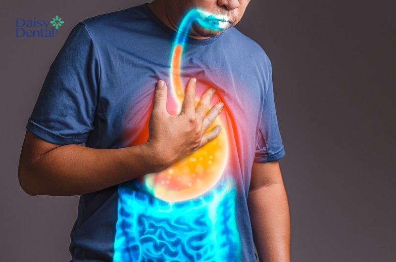 Trào ngược dạ dày là nguyên nhân dẫn đến tình trạng hơi thở có mùi khó chịu