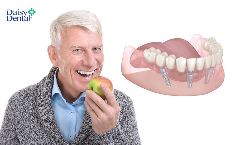 Người sử dụng có thể ăn nhai thoải mái mà không lo gãy, vỡ