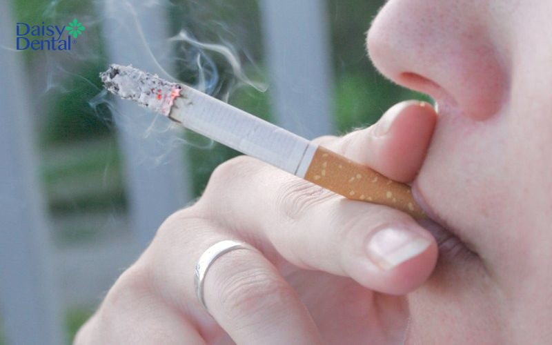 Một trong những hậu quả của hút thuốc lá là mất răng vĩnh viễn