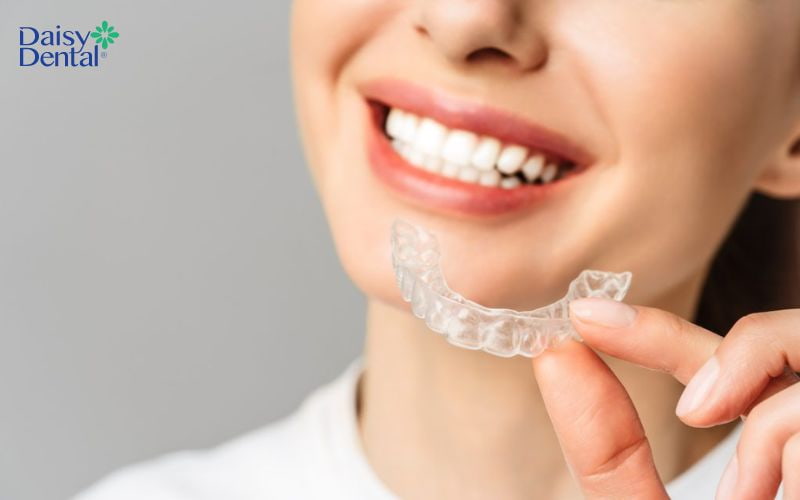 Niềng răng trong suốt được nhiều bệnh nhân lựa chọn nhờ tính thẩm mỹ cao