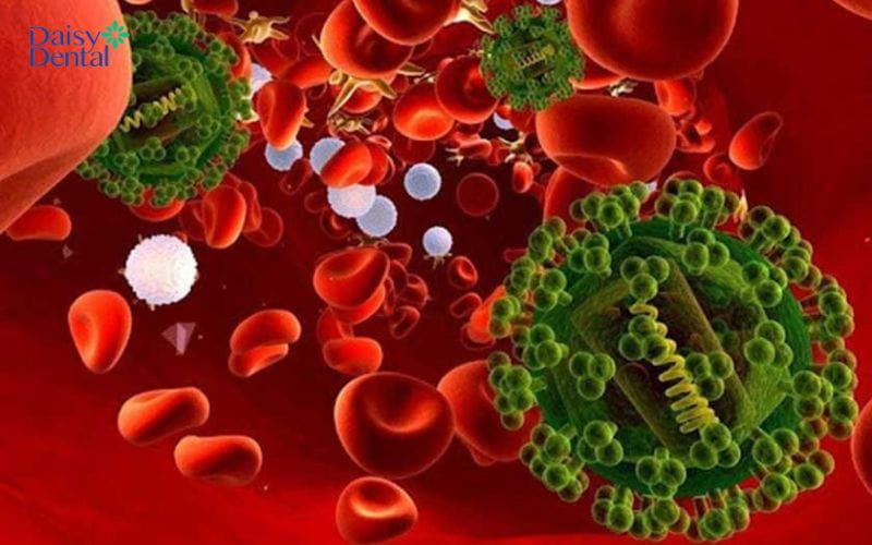 Nhiễm trùng huyết là một trong những biến chứng sau nhổ răng khôn nguy hiểm
