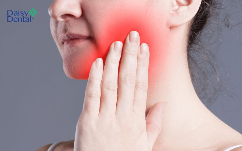 Thông thường nhổ răng khôn bị sưng má sẽ hết sau 2-3 ngày