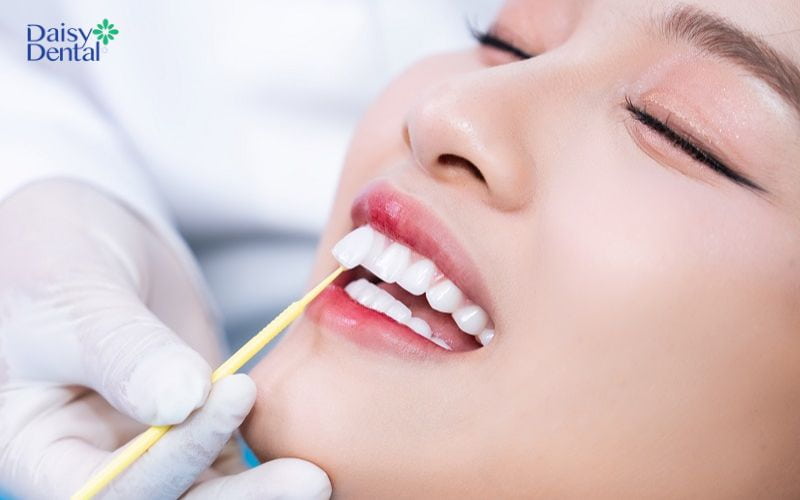 Bọc răng sứ là giải pháp hữu hiệu giúp khắc phục các vết đen trên răng