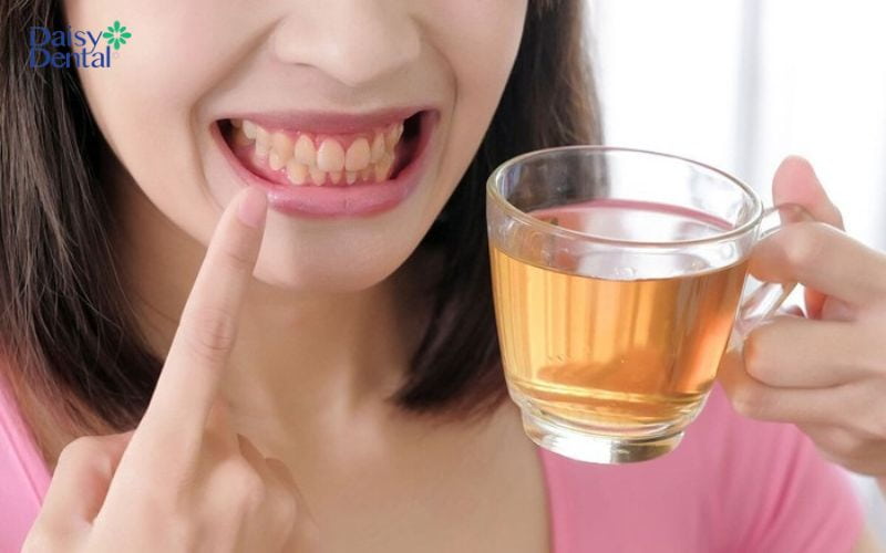 Hãy hạn chế các thực phẩm có thể gây ố màu răng
