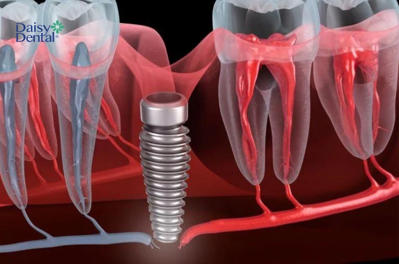 Nếu tình trạng đau nhức kéo dài, bạn nên nhanh chóng đến gặp bác sĩ.