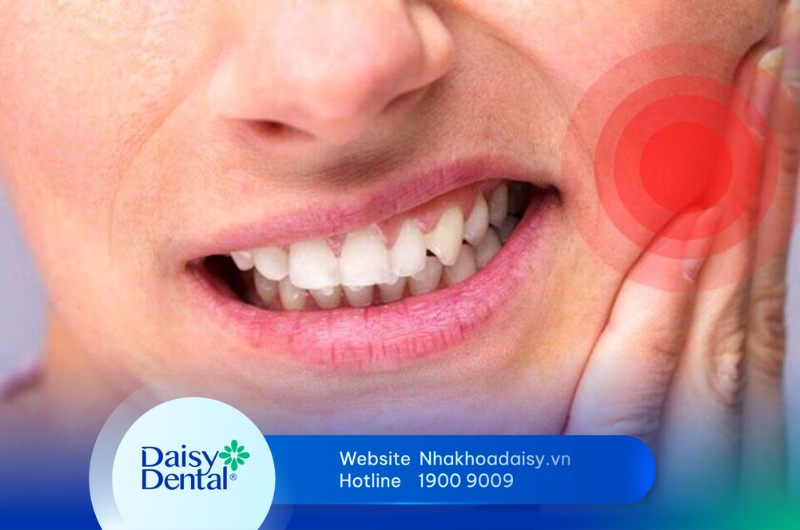 Răng Implant bị đau