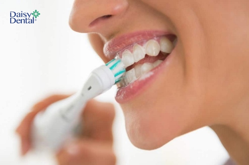 Chăm sóc răng miệng không đúng cách là một trong những nguyên nhân khiến răng bị thưa