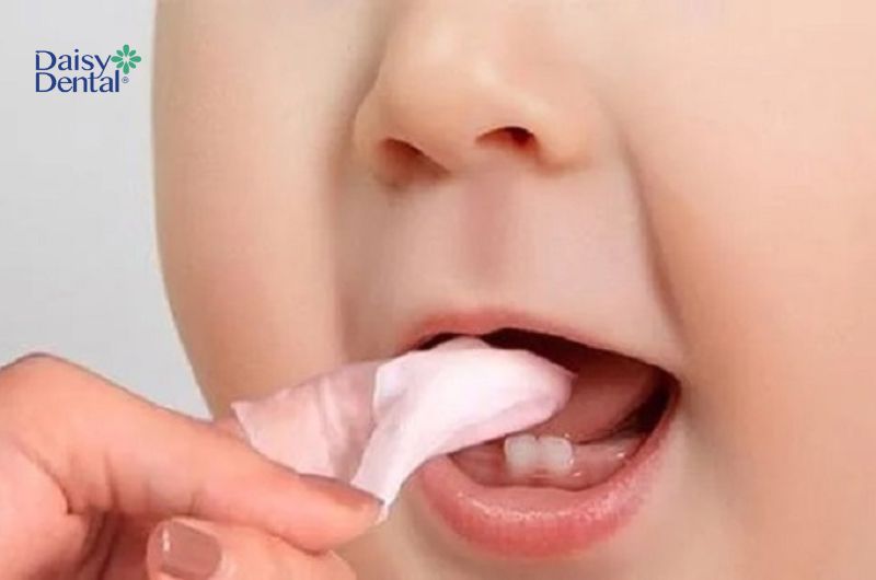 Răng bị xỉn màu khiến trẻ mất tự tin khi cười