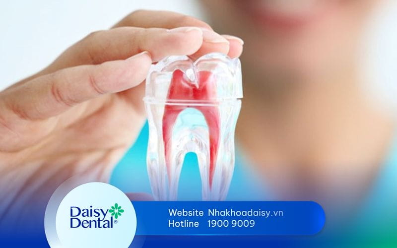 Cách chăm sóc răng sau khi lấy tủy