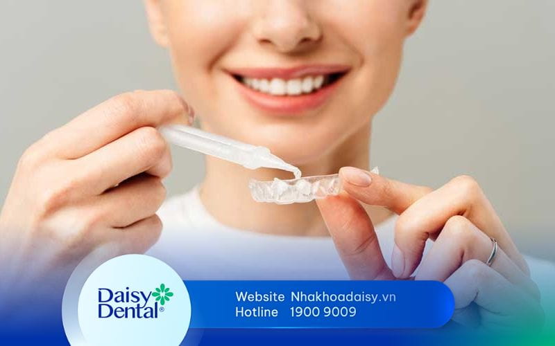 gel tẩy trắng răng