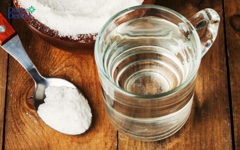 Trị sâu răng vĩnh viễn tại nhà bằng nước muối