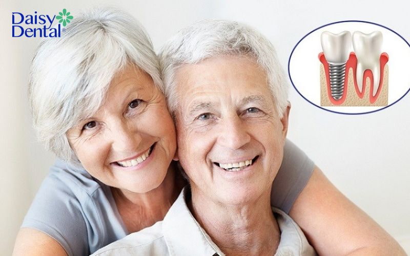 Trồng răng giúp cải thiện thẩm mỹ và duy trì chức năng nhai