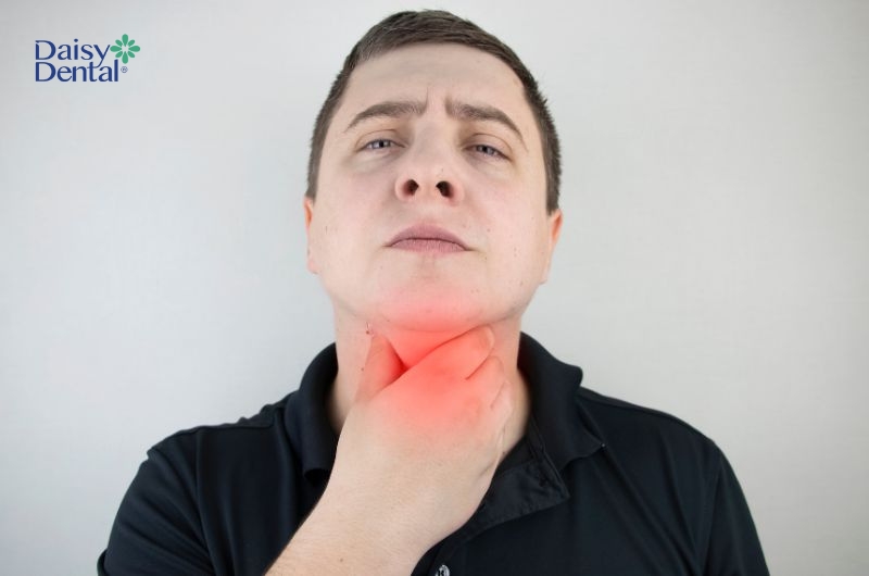 Biểu hiện điển hình nhất của bệnh lý này là đau nhức cổ họng.