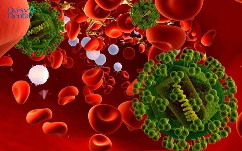 Nếu không điều trị đúng cách, bệnh có thể dẫn đến nhiễm trùng huyết