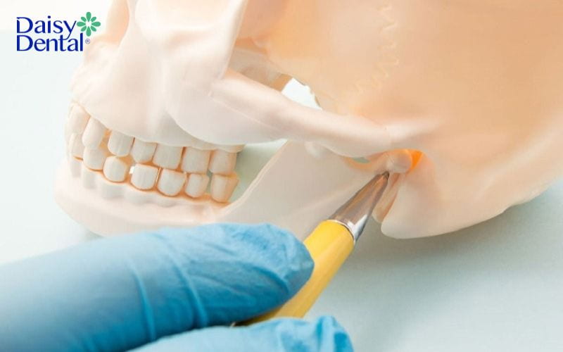 Viêm khớp thái dương hàm tùy tình trạng bệnh sẽ được bác sĩ chỉ định điều trị khác nhau