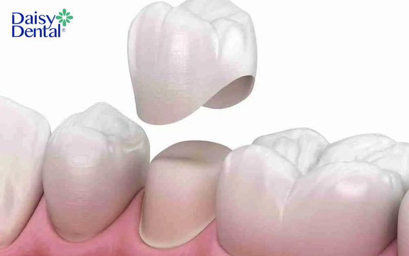 cách làm hết nhức răng nhanh nhất