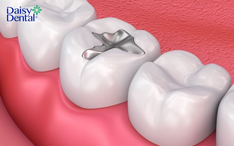 cách làm hết nhức răng nhanh nhất
