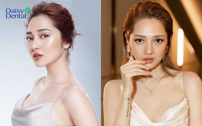 Bảo Anh được mệnh danh là một trong những “mỹ nhân” sở hữu góc xương hàm đẹp nhất Việt Nam